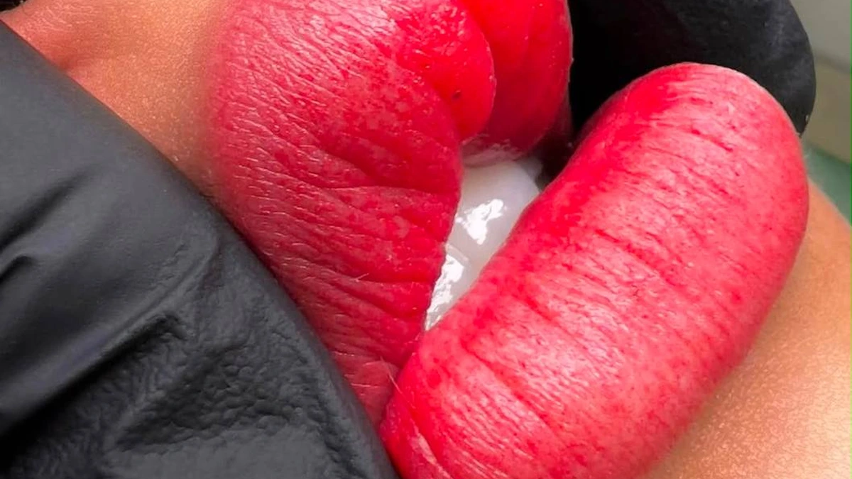 Micro Labial